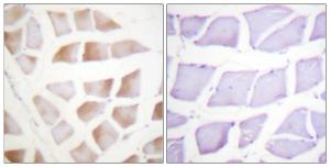 Anti-CRYAB antibody