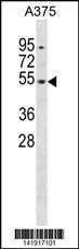 Anti-DUSP10 Rabbit Polyclonal Antibody (AP (Alkaline Phosphatase))