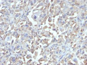 Anti-TNF alpha Mouse Monoclonal Antibody [clone: MAb1]