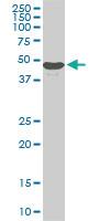 Anti-STK38 Mouse Monoclonal Antibody [clone: 6F1]