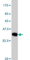 Anti-MYBPC1 Mouse Monoclonal Antibody [clone: 3G4]