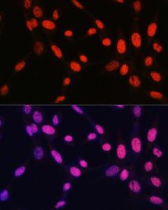 Immunofluorescence analysis of NIH-3T3 cells using Anti-Histone H2B (mono methyl Lys5) Antibody (A93072) at a dilution of 1:100. DAPI was used to stain the cell nuclei (blue).