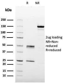 SDS-PAGE analysis of Anti-Prohibitin Antibody [PHB/3227] under non-reduced and reduced conditions; showing intact IgG and intact heavy and light chains, respectively SDS-PAGE analysis confirms the integrity and purity of the antibody