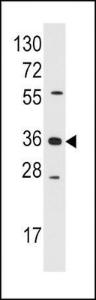 Anti-AKR1B1 Rabbit Polyclonal Antibody