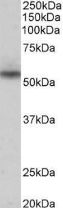 Anti-Nprl3 Antibody (A85003) (0.3µg/ml) staining of Human Heart lysate (35µg protein in RIPA buffer). Primary incubation was 1 hour. Detected by chemiluminescence.