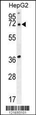 Anti-ACOT11 Rabbit Polyclonal Antibody