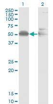 Anti-AHSG Mouse Monoclonal Antibody [clone: 1D8]