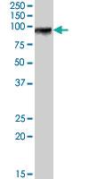 Anti-F13A1 Goat Polyclonal Antibody