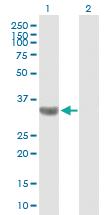 Anti-TBC1D3 Mouse Polyclonal Antibody