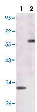 Anti-ESR1 Mouse Monoclonal Antibody [clone: 5D4B1,5D4E3]