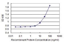 Anti-CD40L Antibody Pair