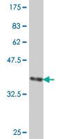 Anti-PRTN3 Mouse Polyclonal Antibody