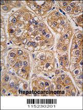 Anti-AKR1A1 Rabbit Polyclonal Antibody