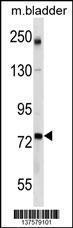 Anti-GCLC Rabbit Polyclonal Antibody (AP (Alkaline Phosphatase))