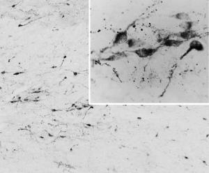 Anti-AGRP Antibody (A83375) (0.05 µg/ml) staining of PFA-perfused cryosection of Human Hypothalamus. Antigen retrieval with citrate buffer pH 6 at 80C for 30min, HRP-staining with Ni-DAB after Biotin-SP-antigoat amplification