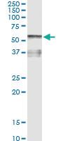 Anti-AHSG Mouse Monoclonal Antibody [clone: 1D8]