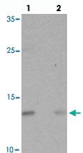 Anti-C9ORF116 Rabbit Polyclonal Antibody