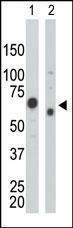 Anti-PKM Rabbit Polyclonal Antibody