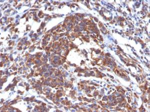 Anti-Vimentin Mouse Monoclonal Antibody [Clone: LN-6]