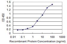 Anti-AHSG Mouse Monoclonal Antibody [clone: 1D8]