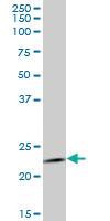 Anti-RAB1B Mouse Monoclonal Antibody [clone: 1B2]