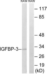 Antibody anti-IGFBP-3 A96572-100 100 µg