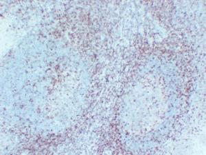 Immunohistochemical analysis of paraffin-embedded human Tonsil using Anti-CD5 Antibody