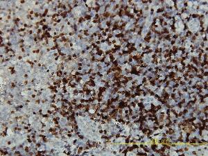 Anti-CAMK4 Mouse Monoclonal Antibody [clone: 1A3]