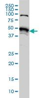 Anti-STK38 Mouse Monoclonal Antibody [clone: 6F1]