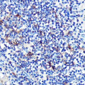 Immunohistochemistry analysis of paraffin-embedded human spleen using Anti-HLA-DR Antibody [ARC0518] (A8814) at a dilution of 1:100 (40X lens). Perform microwave antigen retrieval with 10 mM PBS buffer pH 7.2 before commencing with IHC staining protocol