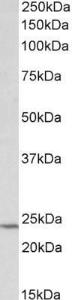 Anti-TIMP1 antibody