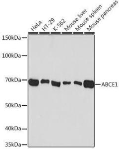 Western blot analysis of extracts of various cell lines, using Anti-ABCE1 Antibody [ARC1445] (A305270) at 1:1,000 dilution. The secondary antibody was Goat Anti-Rabbit IgG H&L Antibody (HRP) at 1:10,000 dilution.