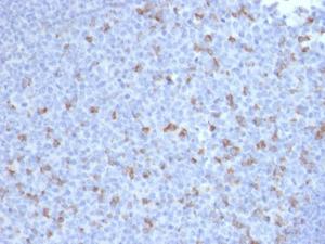 Immunohistochemical analysis of formalin-fixed, paraffin-embedded human tonsil using Anti-PD1 Antibody [PDCD1/2720]