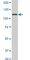 Anti-PTK7 Mouse Monoclonal Antibody [clone: 4D4]