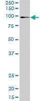 Anti-ATP2C1 Rabbit Polyclonal Antibody