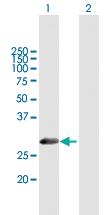 Anti-METAP1 Mouse Polyclonal Antibody