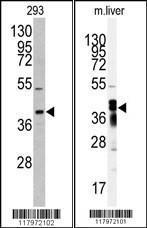 Anti-AKR7A2 Rabbit Polyclonal Antibody