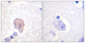 Antibody anti-C-RAF A95898-100 100 µg