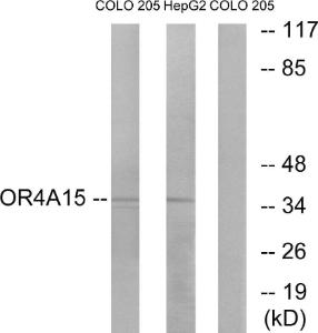 Western blot analysis of lysates from COLO and HepG2 cells using Anti-OR4A15 Antibody. The right hand lane represents a negative control, where the antibody is blocked by the immunising peptide