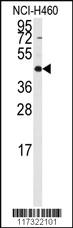 Anti-RMND5B Rabbit Polyclonal Antibody