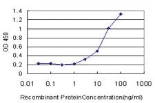 Anti-PTK7 Mouse Monoclonal Antibody [clone: 4D4]