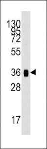 Anti-ALDOA Rabbit Polyclonal Antibody