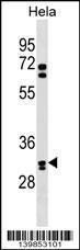 Anti-OR6B2 Rabbit Polyclonal Antibody (FITC (Fluorescein Isothiocyanate))