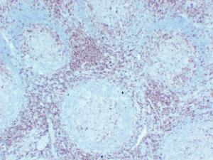 Immunohistochemical analysis of paraffin-embedded human Tonsil using Anti-CD5 Antibody