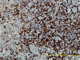 Anti-CAMK4 Mouse Monoclonal Antibody [clone: 1A3]