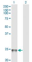 Anti-RAB1B Mouse Monoclonal Antibody [clone: 1B2]