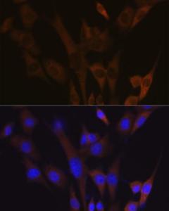 Immunofluorescence analysis of NIH-3T3 cells using Anti-ABCE1 Antibody [ARC1445] (A305270) at a dilution of 1:100 (40x lens). DAPI was used to stain the cell nuclei (blue).