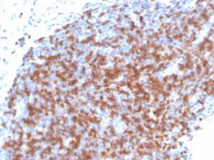 Immunohistochemical analysis of formalin-fixed, paraffin-embedded human tonsil using Anti-ZAP70 Antibody [ZAP70/4040R]