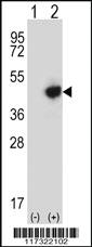 Anti-RMND5B Rabbit Polyclonal Antibody