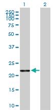 Anti-AK1 Mouse Polyclonal Antibody